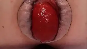 Contender For Biggest Prolapse (Male Warning!)