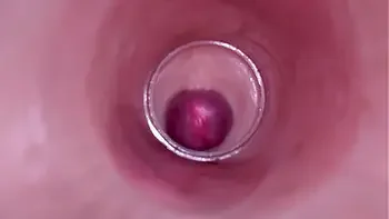 Female Insemination - Internal Camera Captures Deep Male Ejaculation