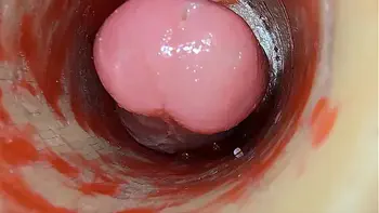 Camera Inside Deep Pussy Captures Dose Ejaculation of Sperm ASMR