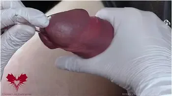 Perfect Extraction Of Sperm Directly From The Urethra. Close-up Of The Glass Straw Sounding