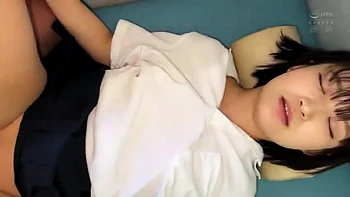 504-youth-with-areare-ukd