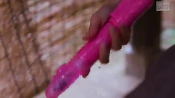 160-youth-with-areare-sfs