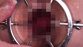 x2xFCFCC5776C9B59886D