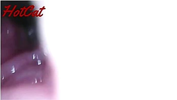 Endoscopic Vaginal Observation