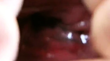 Amateur Anal Stretching My Elastic Asshole