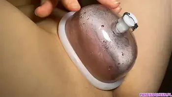 The fattest pussy ever - result after 40 minutes pumping